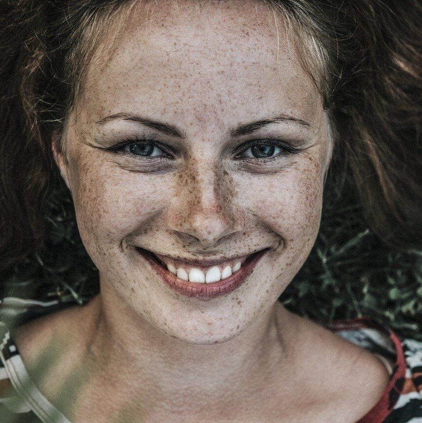 Frau mit Sommersprossen