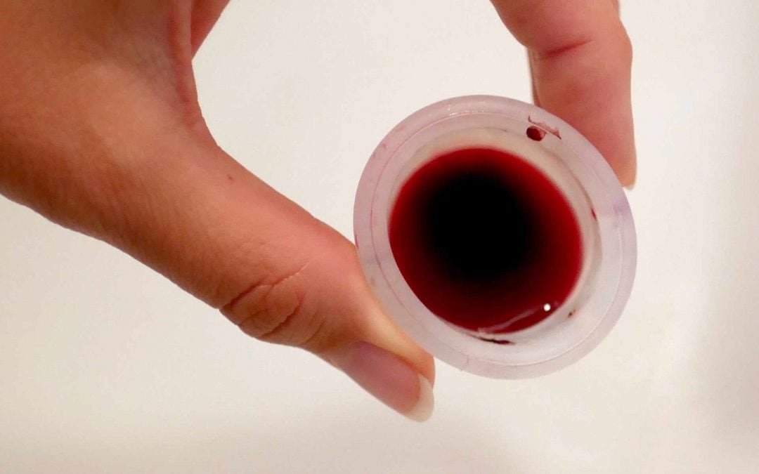 Spanien ermöglicht Menstruations“urlaub“