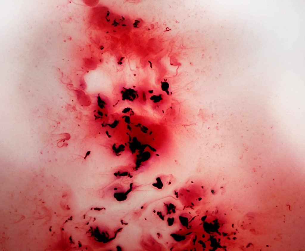 Der Menstruationsurlaub soll auch dazu beitragen, die weibliche Periode zu entstigmatisieren. Foto: Vulvani