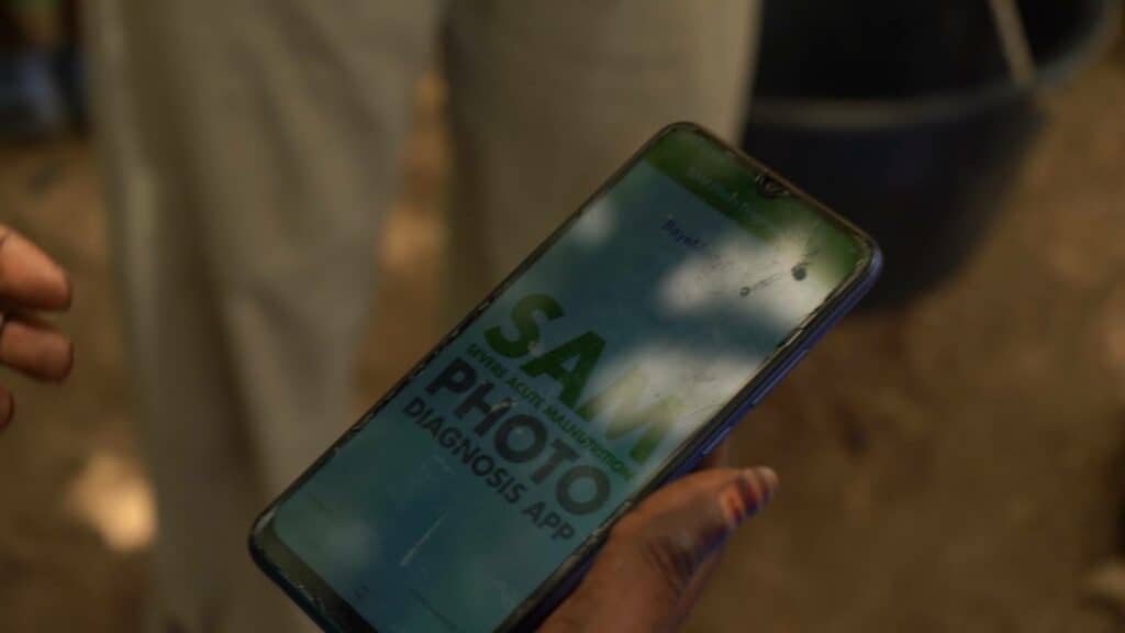Neue App könnte Mangelernährung im Senegal bekämpfen