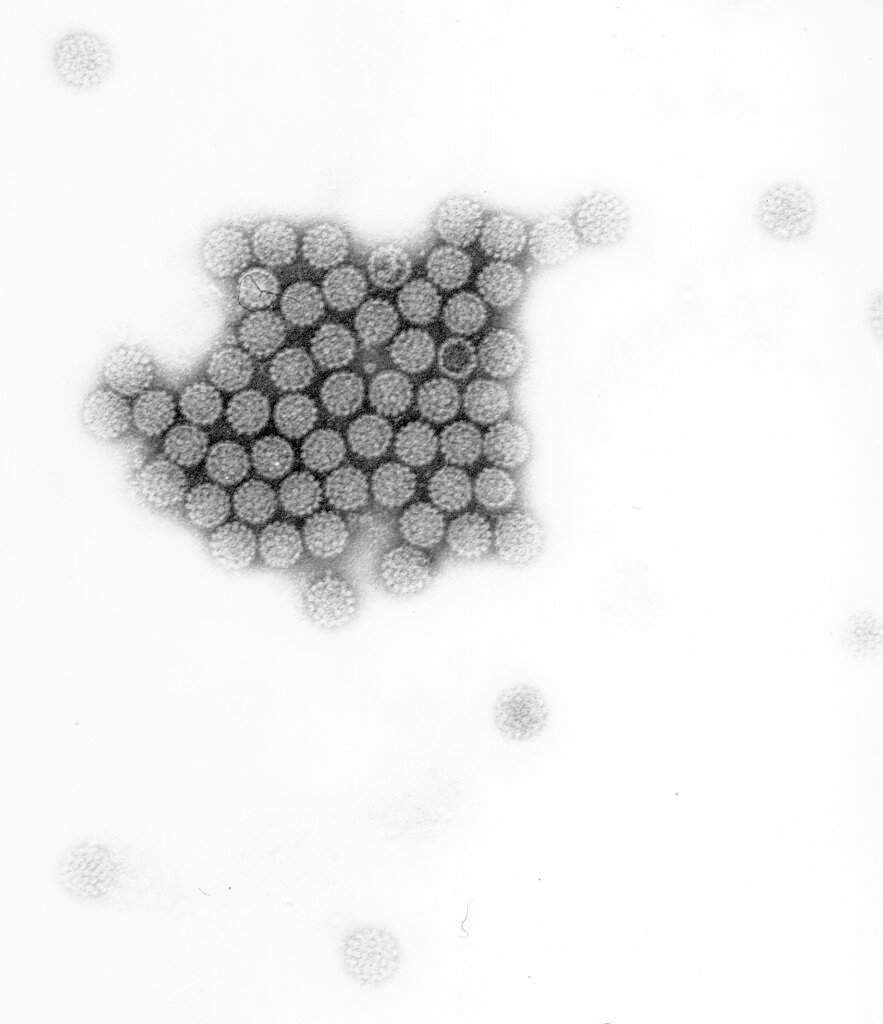 HPV Viren