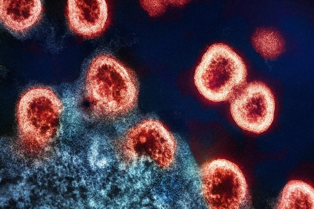 HIV virus