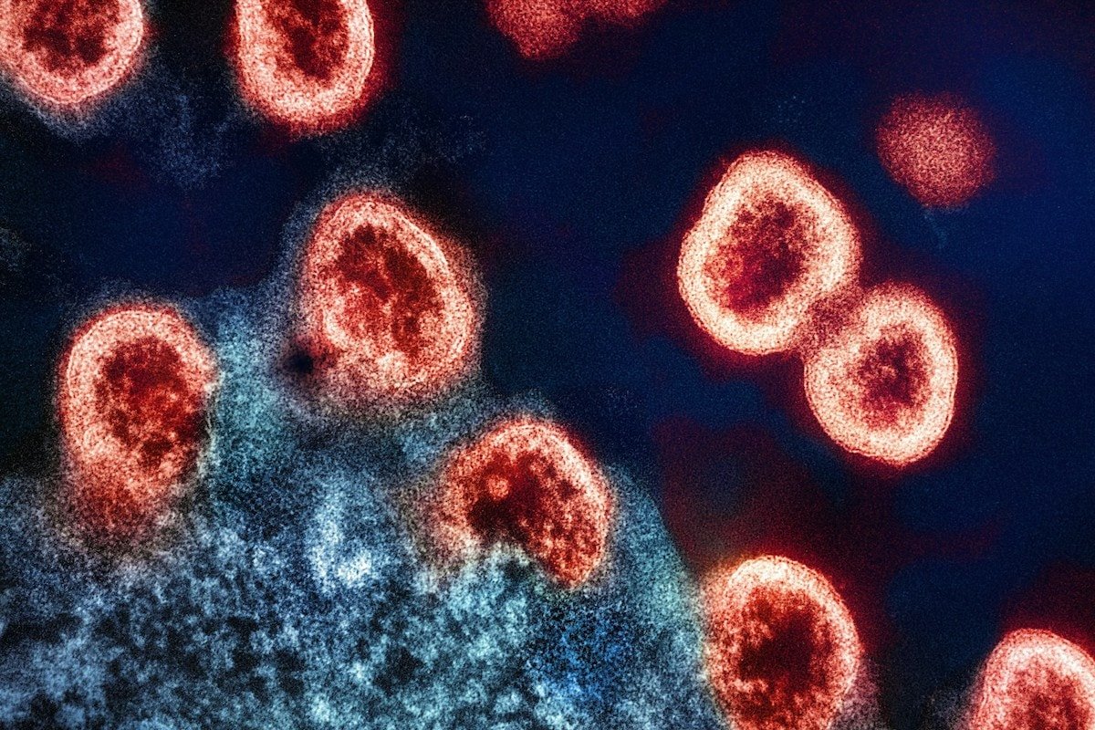 HIV virus