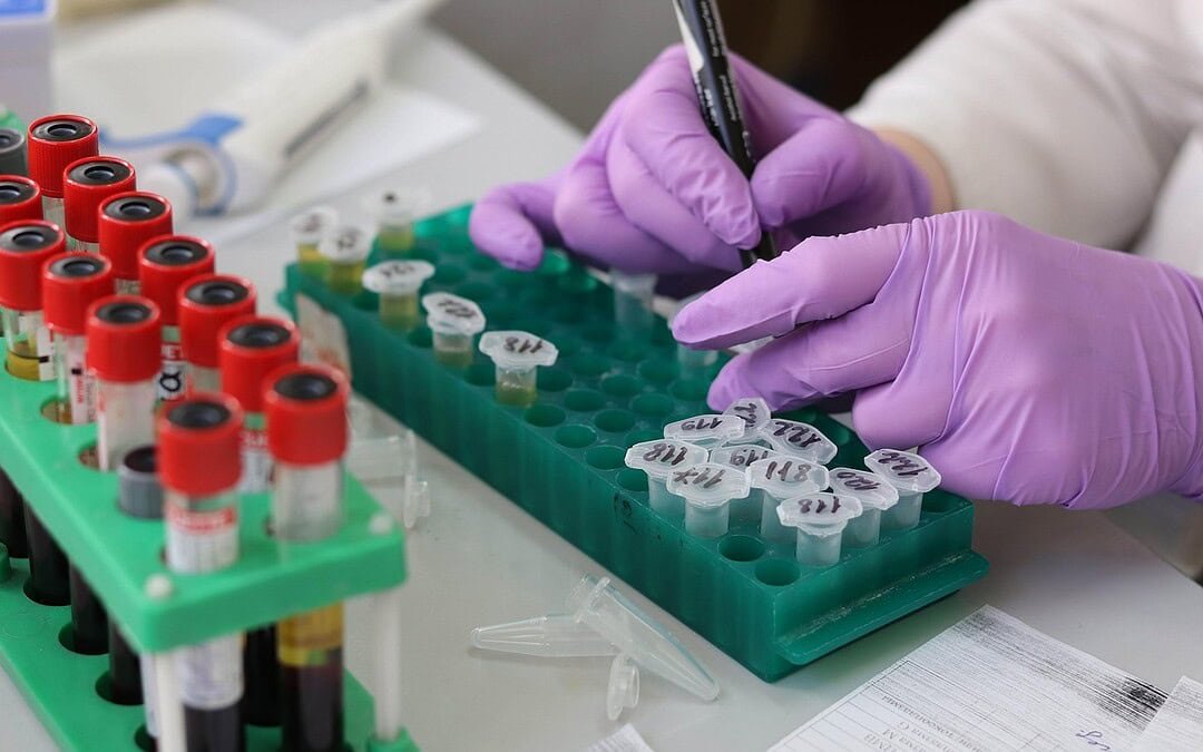 HPV-Impfung senkt Todesfälle durch Gebärmutterhalskrebs in England auf historischen Tiefstand