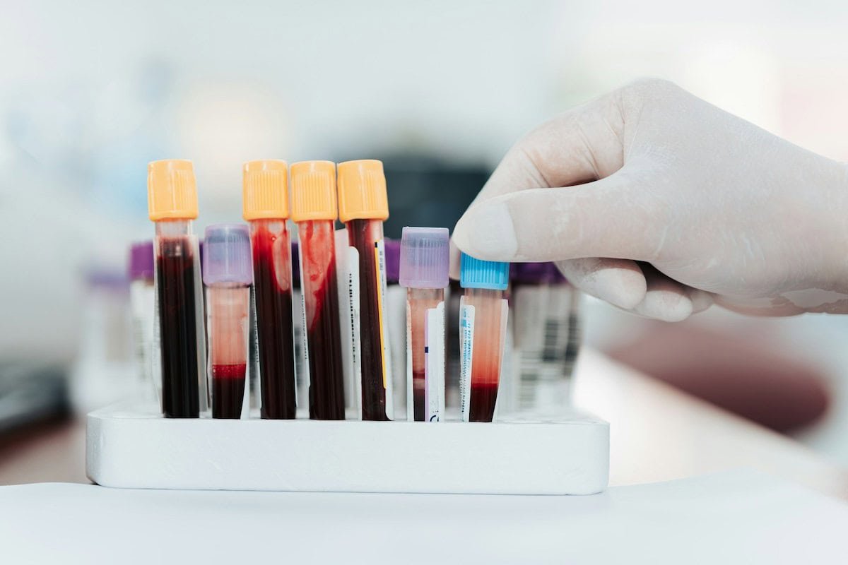 Blut Labor